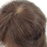 Próteses Capilar  natural  Micropele  perfeita para cobertura de falhas capilar ou acabamentFeminina