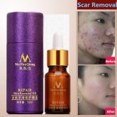 Óleo Cicatrizante de Estrias e Acnes