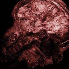 Thanatopsis - "Stages Of Decomposition"