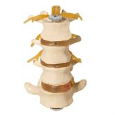 Vértebras Lombares 4 Pçs-CS/AT/TGD-0153-C