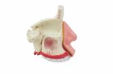 Cavidade Nasal-CS/SD-5042