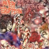 Artery Eruption - Gouging Out Eyes of Mutilated Infants