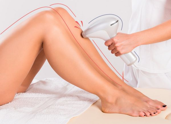 Depilação a laser Pacote com 10 sessões