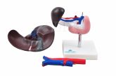 Figado, Pâncreas, Baço e Duodeno-CS/SD-5050
