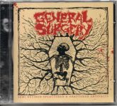 General Surgery - Semi Retired Splattered & Shattered Artifacts