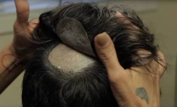 Proteses Capilar Masculina em Silicone