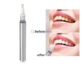 CANETA BRANQUEADORA DE  DENTES