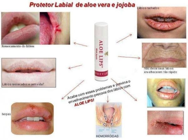 Aloe Lips