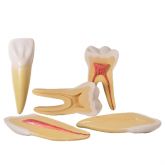 Dentes Ampliados-Canino,Incisivo e Molar-CS/AT/TGD-0311-A