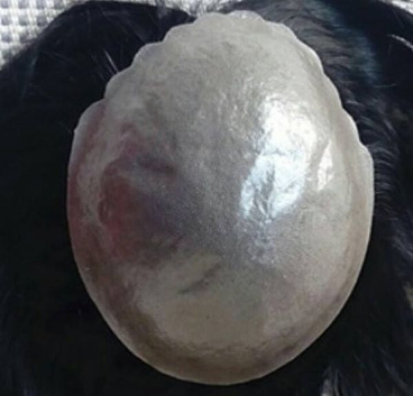 Proteses Capilar Masculina em Silicone