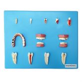 Placa c/ Doenças Dentárias 12 Pçs CS/AT/TZJ-0311-P