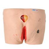 Modelo de Úlcera por Pressão-CS/AT/TZJ-4009C