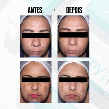 CREAMY GEL EFEITO PEELING GLICOINTENSE PEEL 30G