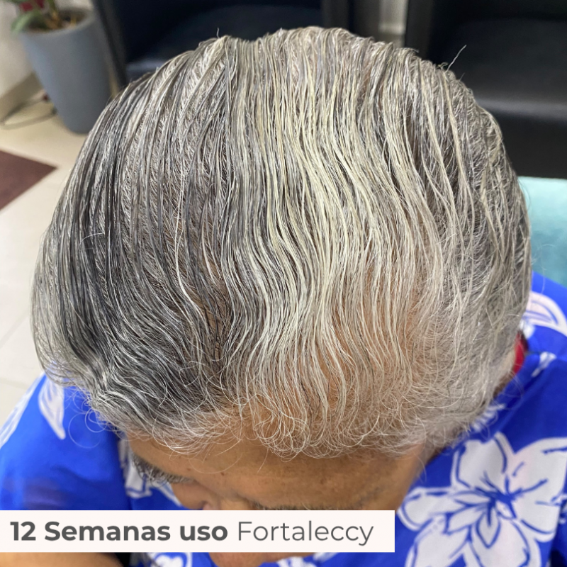TRATAMENTO 3 MESES FORTALECCY     CABELOS | UNHAS | SOBRANCELHAS