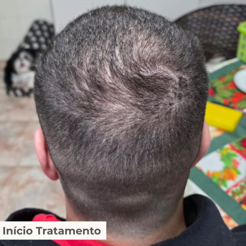TRATAMENTO 3 MESES FORTALECCY     CABELOS | UNHAS | SOBRANCELHAS