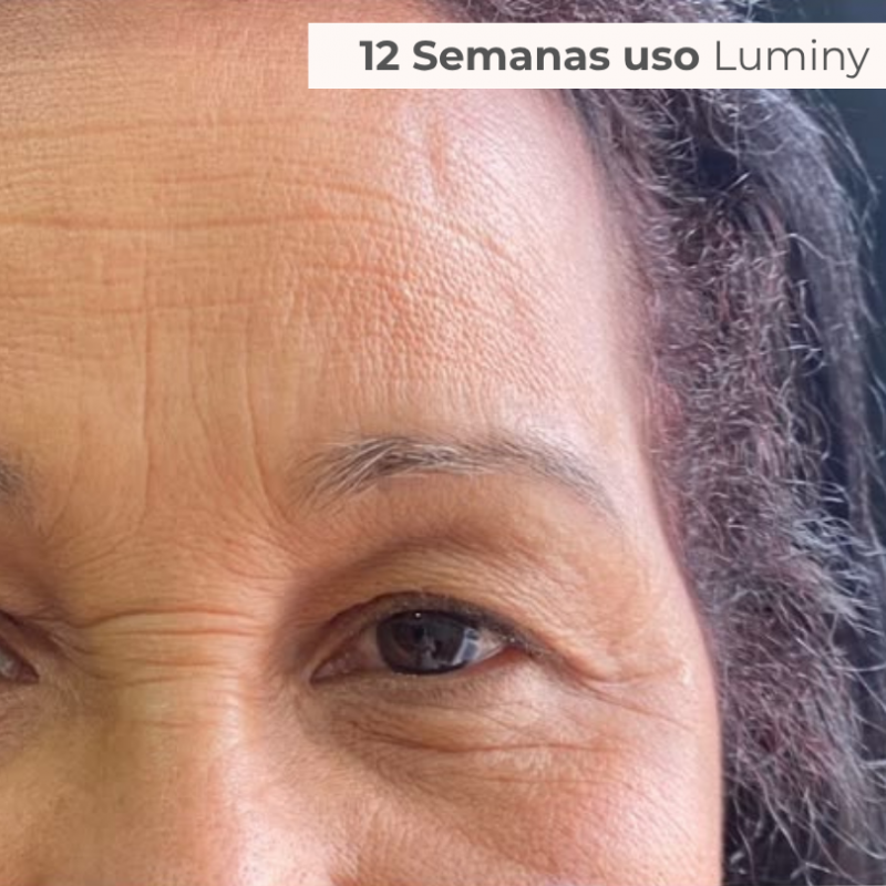 PACK TRATAMENTO 3 MESES BLEND LUMINY ADVANCE SKINCARE