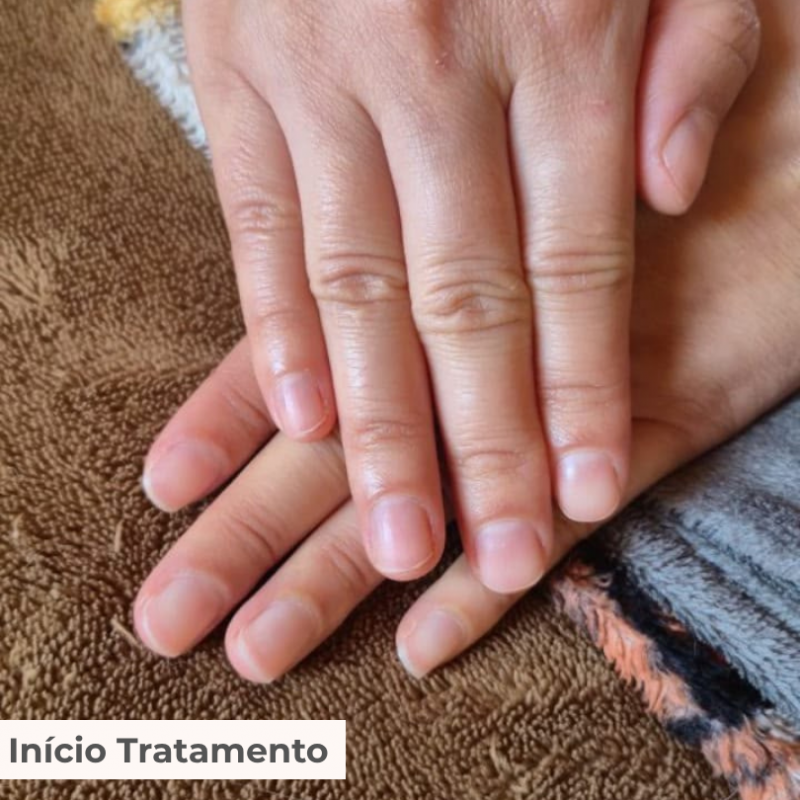 TRATAMENTO 3 MESES FORTALECCY     CABELOS | UNHAS | SOBRANCELHAS
