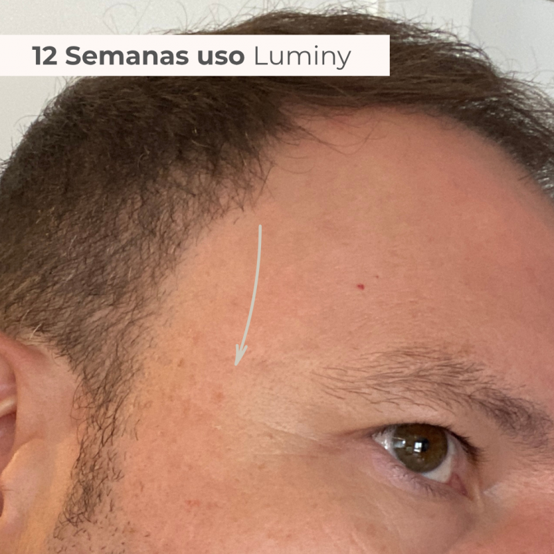 PACK TRATAMENTO 3 MESES BLEND LUMINY ADVANCE SKINCARE