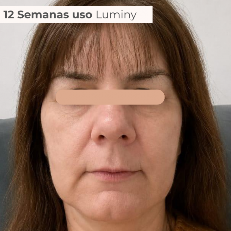 PACK TRATAMENTO 3 MESES BLEND LUMINY ADVANCE SKINCARE