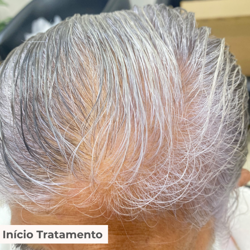 TRATAMENTO 3 MESES FORTALECCY     CABELOS | UNHAS | SOBRANCELHAS