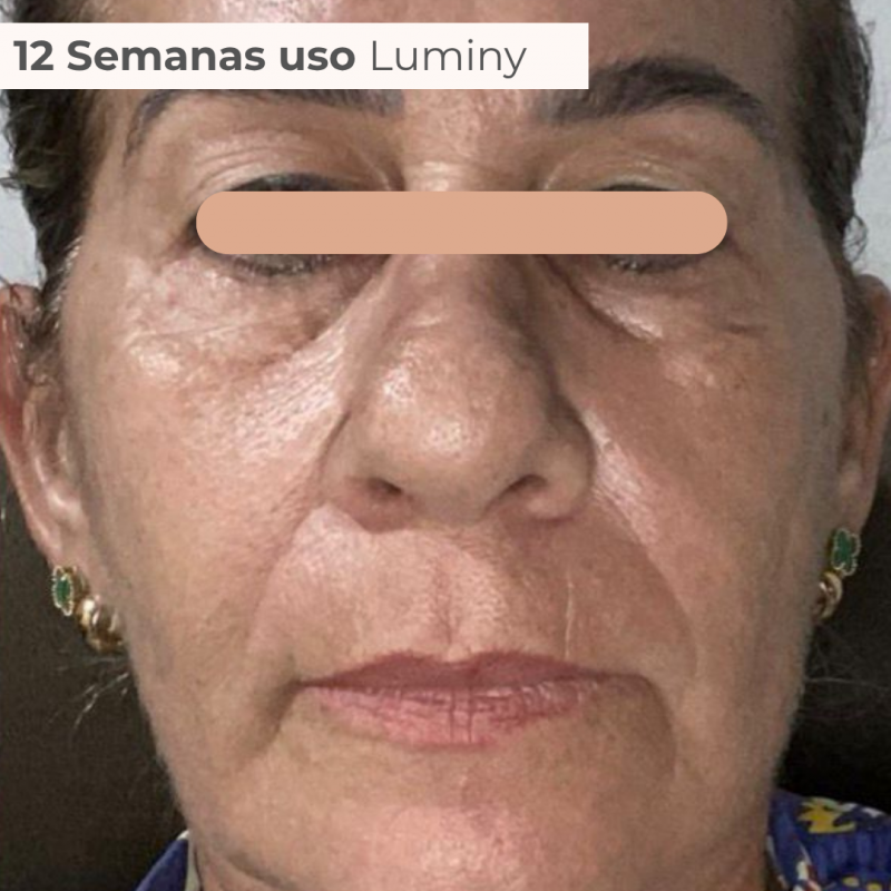 PACK TRATAMENTO 3 MESES BLEND LUMINY ADVANCE SKINCARE