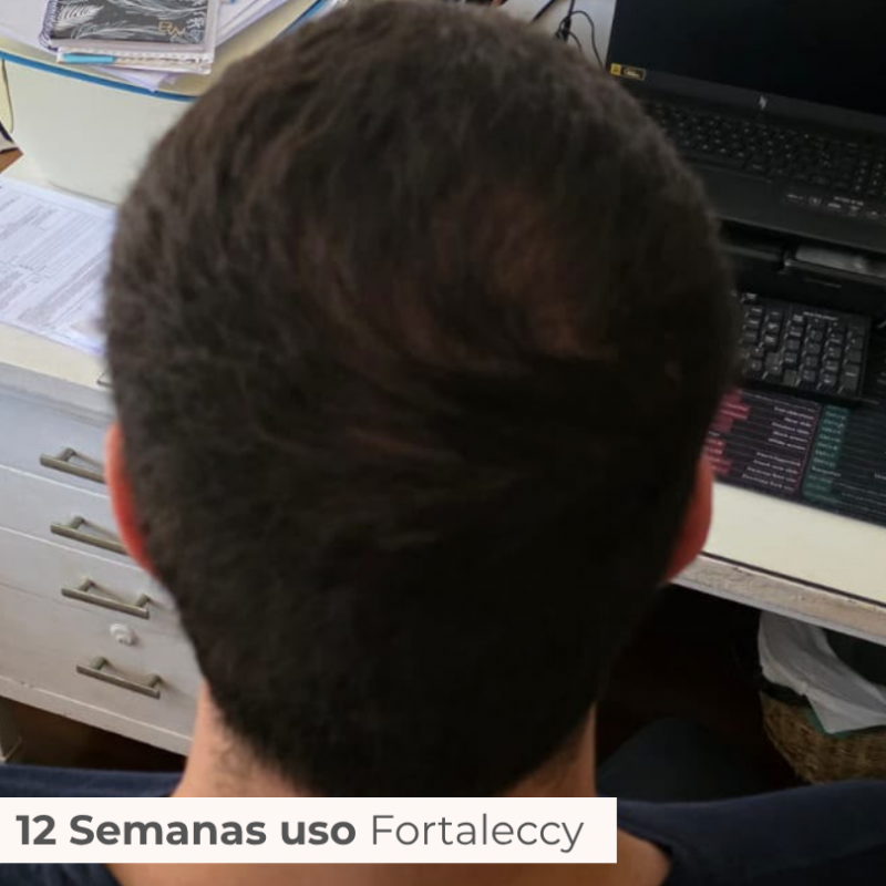 TRATAMENTO 3 MESES FORTALECCY     CABELOS | UNHAS | SOBRANCELHAS
