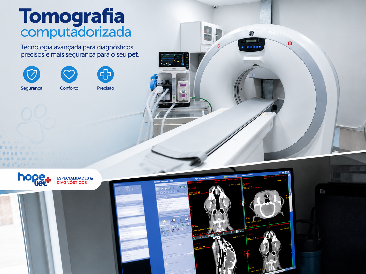 Tomografia Computadorizada